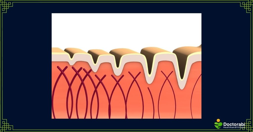 Skin-Structure